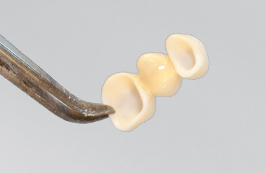 Keramikbr&Atilde;&frac14;cke