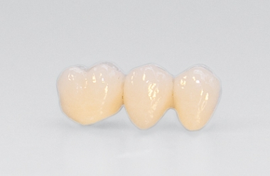 Keramikbr&Atilde;&frac14;cke